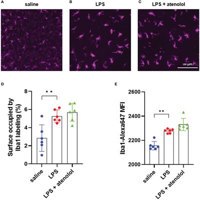 ß1-adrenergic blockers preserve neuromuscular function by inhibiting the production of extracellular traps during systemic inflammation in mice